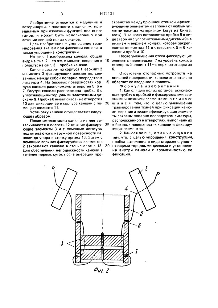 Канюля для полых органов (патент 1673131)