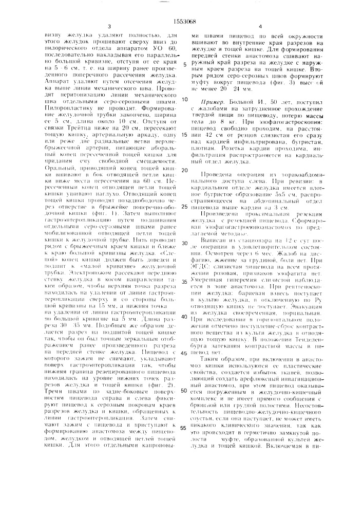 Способ проксимальной резекции желудка (патент 1553068)