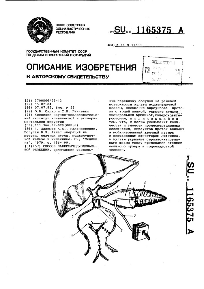 Способ панкреато-дуоденальной резекции (патент 1165375)