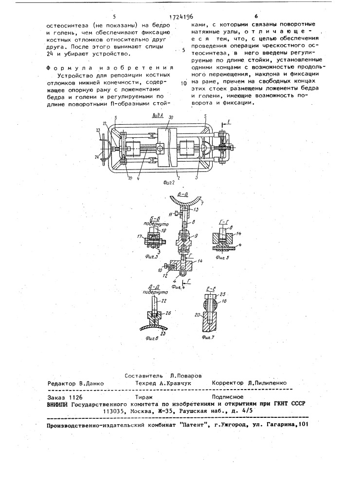 Устройство для репозиции костных отломков нижней конечности (патент 1724196)