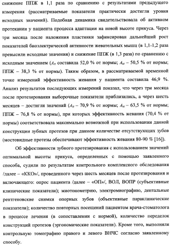 Способ определения оптимальной высоты прикуса (патент 2354300)