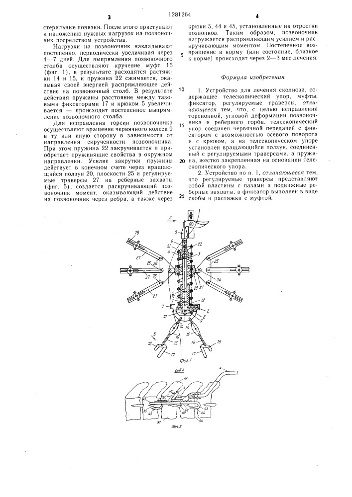 Устройство для лечения сколиоза (патент 1281264)