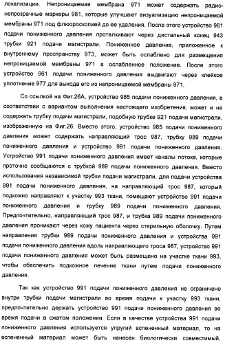 Устройство для лечения путем подкожной подачи пониженного давления с использованием текучей магистрали и связанный с ним способ (патент 2405459)