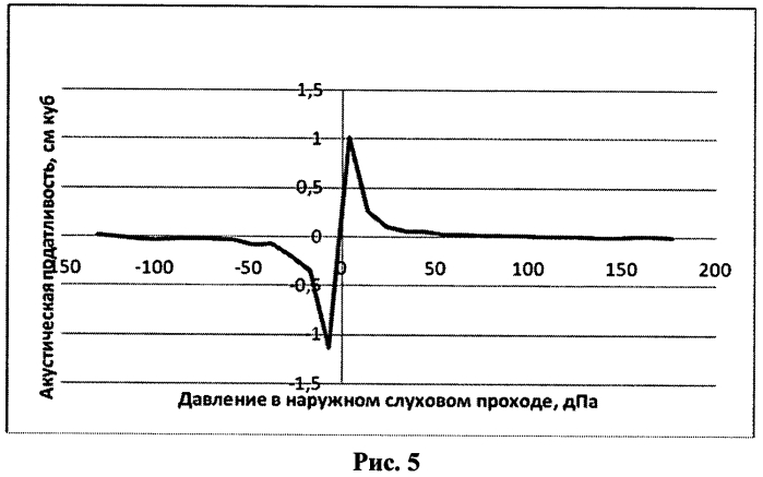 Способ диагностики внутричерепной гипертензии у детей (патент 2570545)