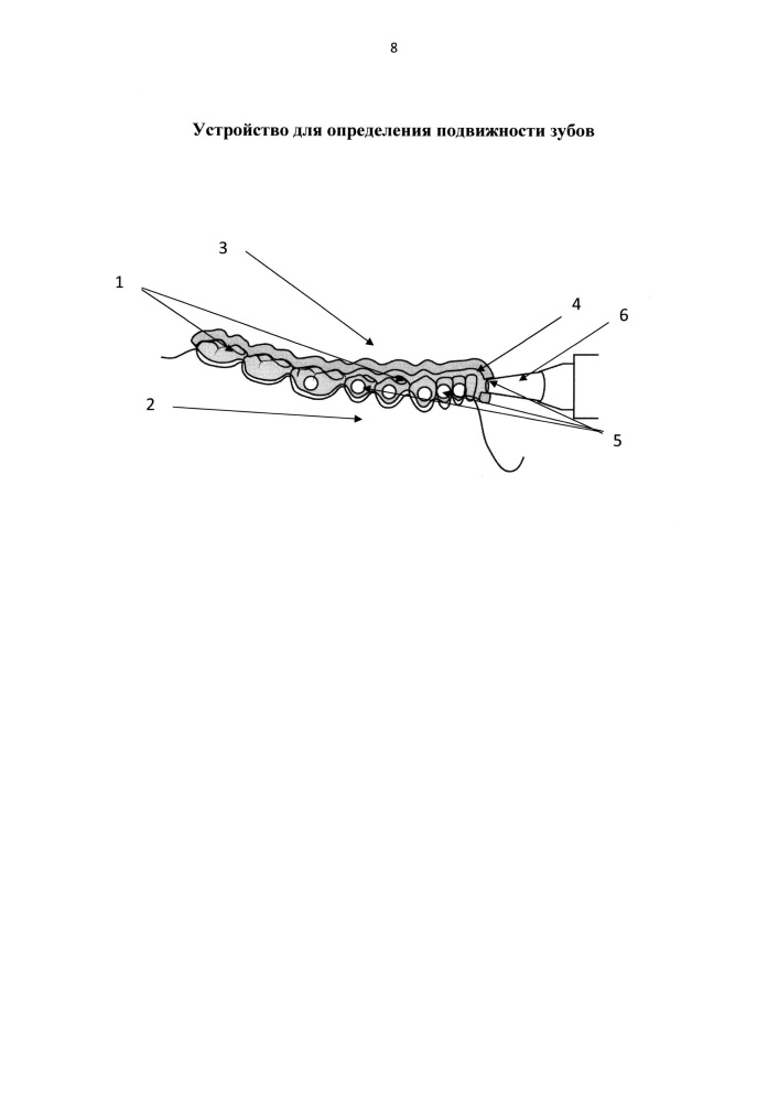 Устройство для определения подвижности зубов (патент 2630355)