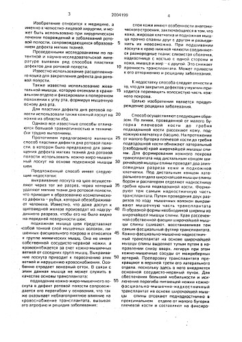 Способ пластики дефекта дна ротовой полости (патент 2004199)