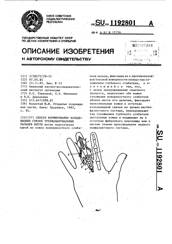 Способ формирования кольцевидных связок трехфалангиальных пальцев кисти (патент 1192801)