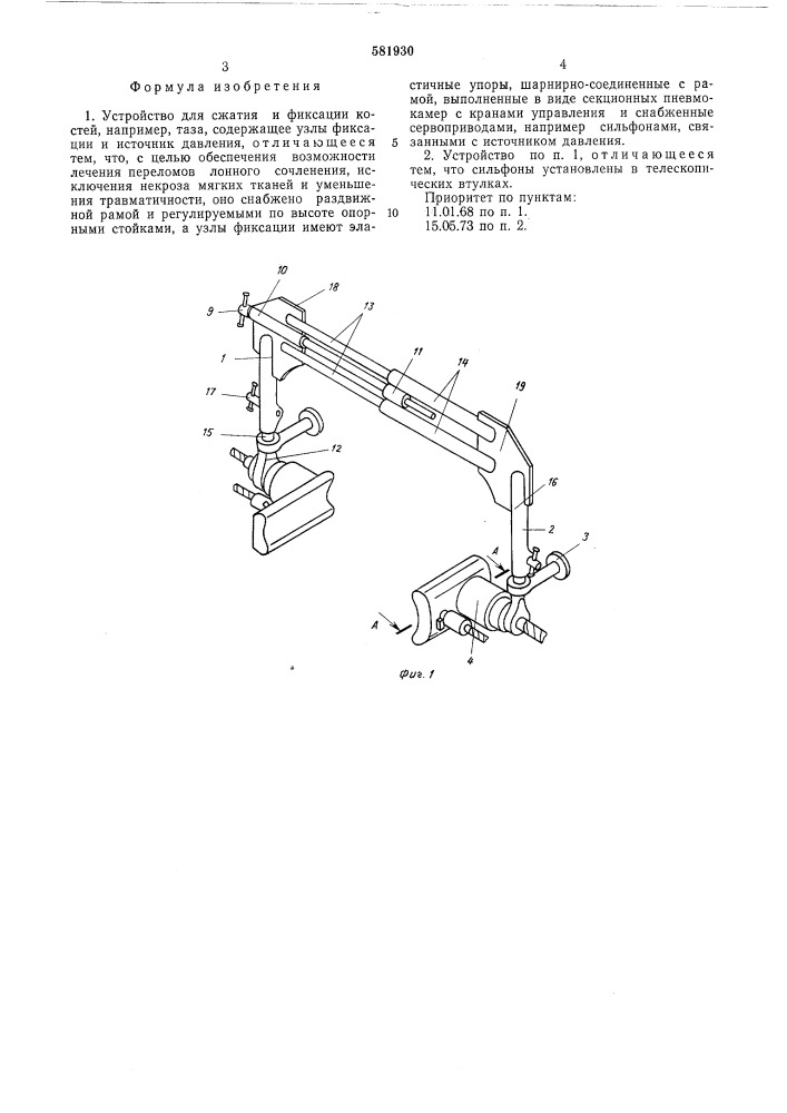 Устройство для сжатия и фиксации костей (патент 581930)