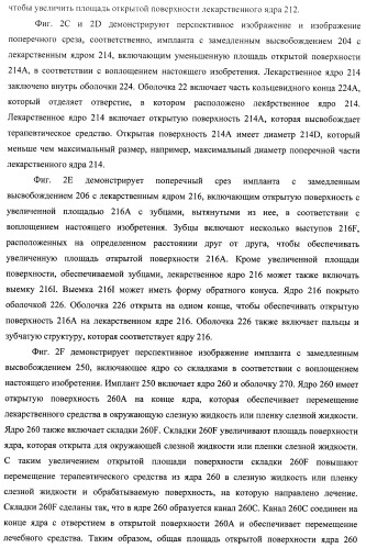 Лекарственные ядра для замедленного высвобождения терапевтических средств (патент 2478366)