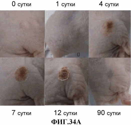 Конъюгаты rgd-(бактерио)хлорофилл для фотодинамической терапии и визуализации некротических опухолей (патент 2518296)