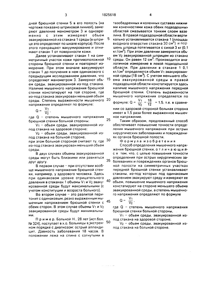 Способ определения мышечного напряжения брюшной стенки (патент 1825618)