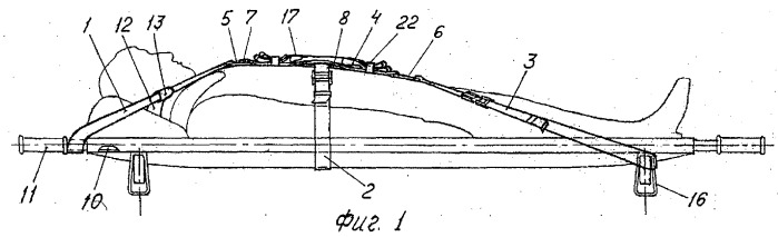 Привязная система для санитарных носилок (патент 2261694)