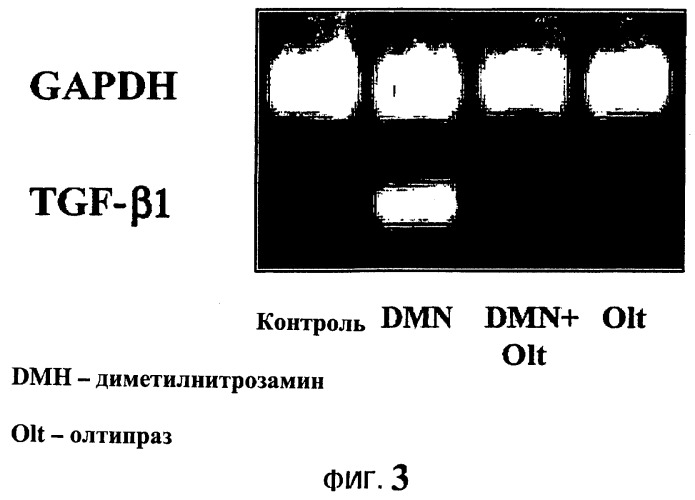Применение олтипраза для профилактики и лечения фиброза и цирроза печени и фармацевтическая композиция, содержащая олтипраз (патент 2258509)