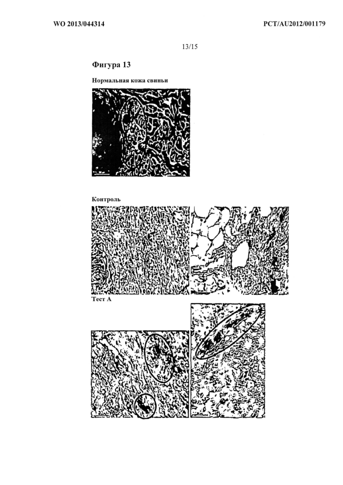 Синтез эластического волокна in vivo (патент 2602861)