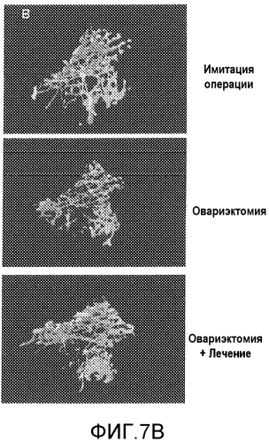 Лечение остеопороза (патент 2562976)