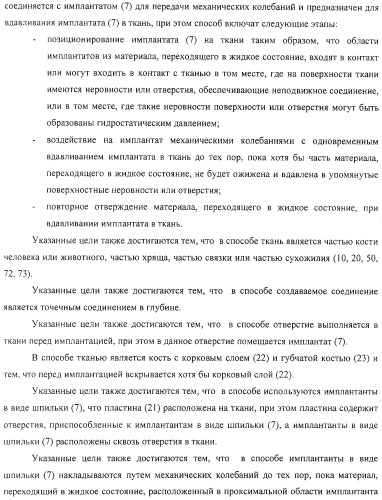 Имплантаты для создания соединений с тканями, в частности со скелетом, а также устройство и способ имплантации (патент 2314768)