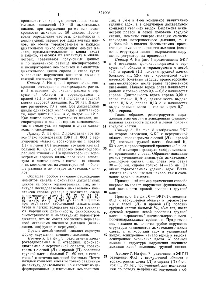 Патент ссср  824996 (патент 824996)