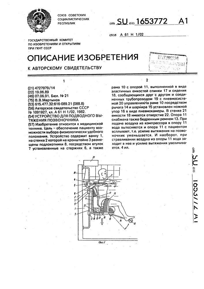 Устройство для подводного вытяжения позвоночника (патент 1653772)