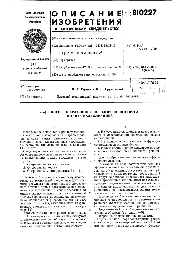 Способ оперативного лечения привыч-ного вывиха надколенника (патент 810227)