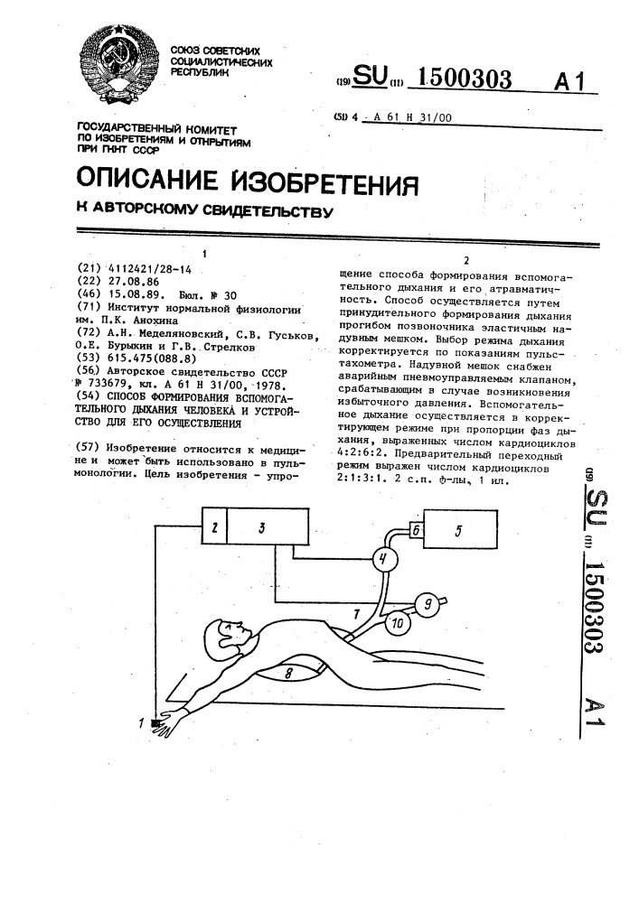 Способ формирования вспомогательного дыхания человека и устройство для его осуществления (патент 1500303)