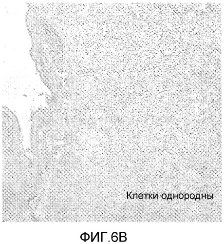 Композиции внеклеточного матрикса для лечения рака (патент 2523339)