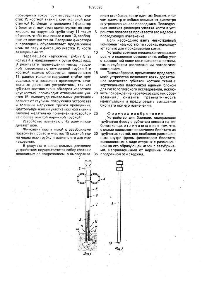 Устройство для биопсии (патент 1690693)
