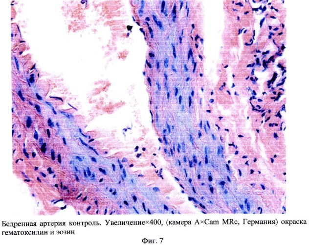 Способ моделирования атеросклероза (патент 2500041)