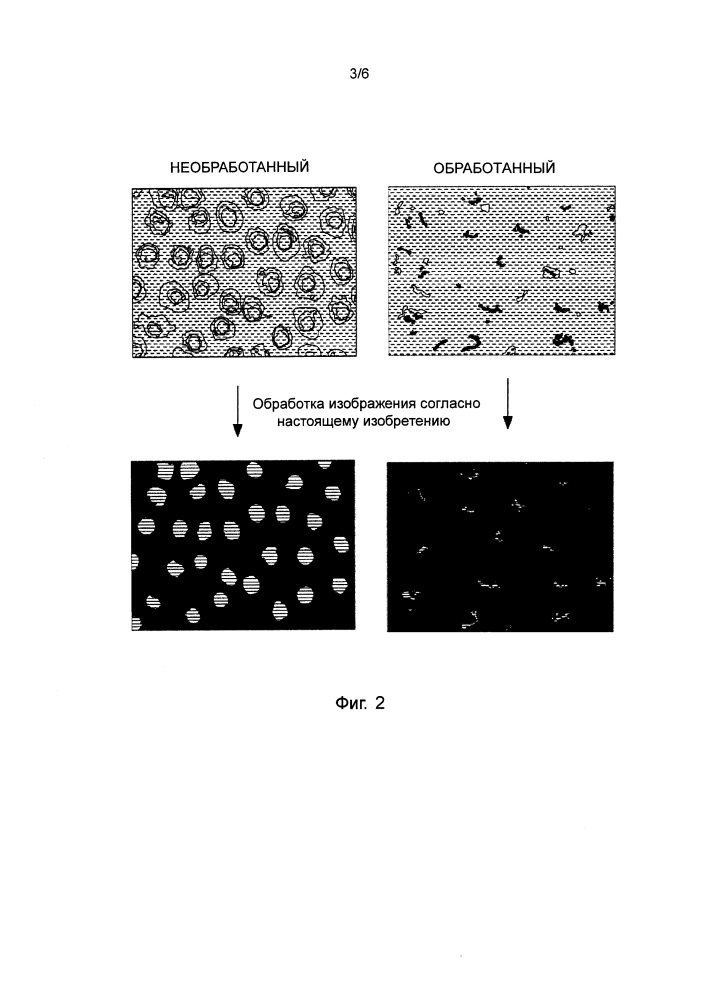 Обработка изображения канальцев дентина (патент 2635290)