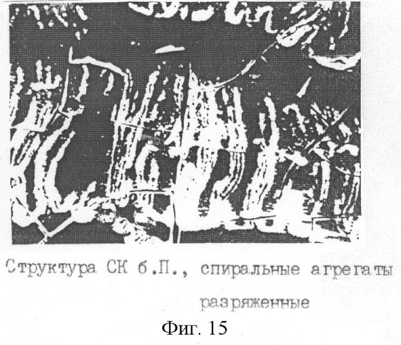 Способ экспресс-диагностики гипер-бета 2-микроглобулинемии (патент 2259565)