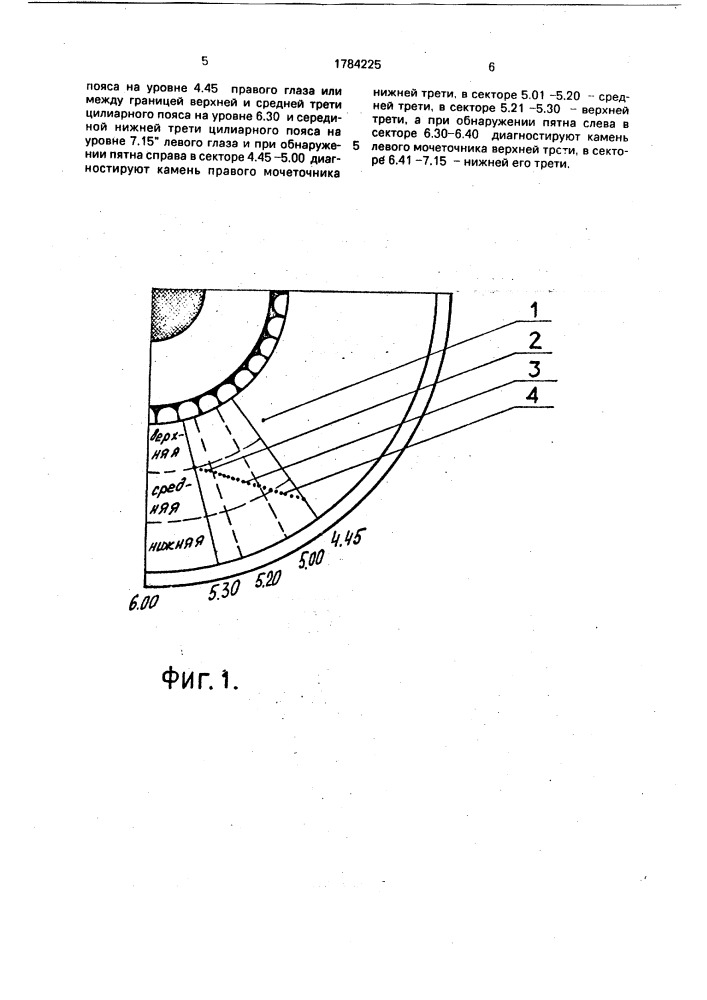 Способ диагностики камней мочеточника (патент 1784225)
