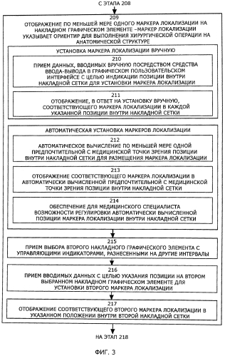 Система для осуществления локализации передней крестообразной связки с применением визуализации (патент 2575055)