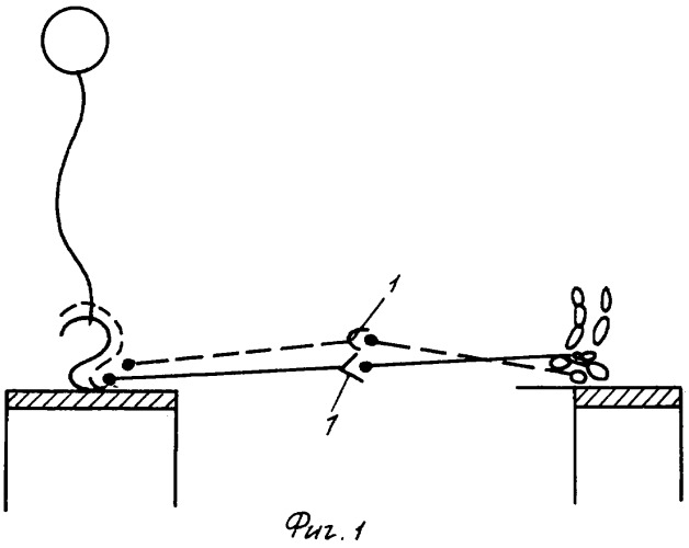 Способ диагностики контрактуры коленного сустава (патент 2321343)