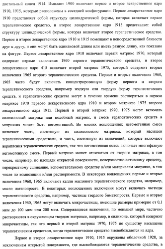 Лекарственные ядра для замедленного высвобождения терапевтических средств (патент 2478366)