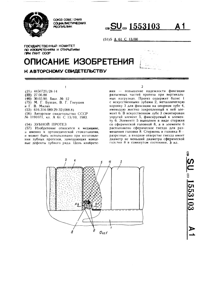 Зубной протез (патент 1553103)