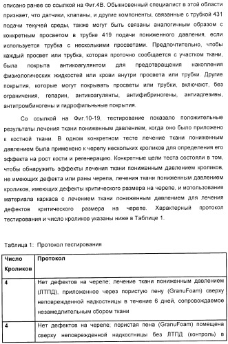 Система и способ продувки устройства пониженного давления во время лечения путем подачи пониженного давления (патент 2404822)