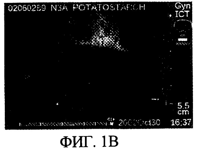 Обнаруживаемая с помощью ультразвука внутриматочная система и способ улучшения ультразвукового обнаружения (патент 2389451)