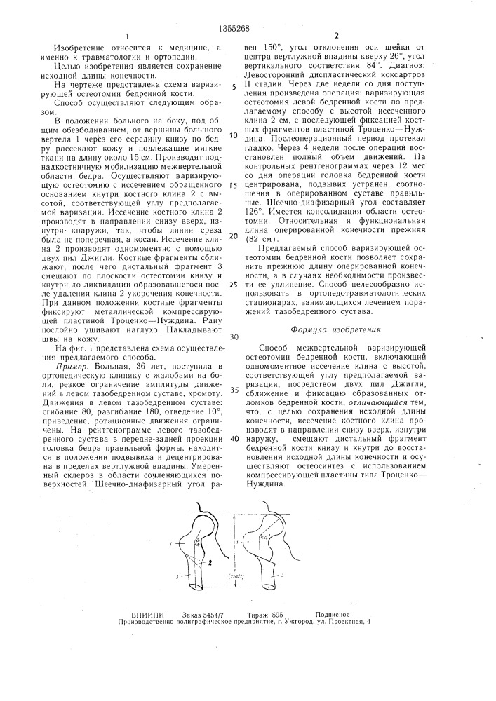Способ межвертельной варизирующей остеотомии бедренной кости (патент 1355268)