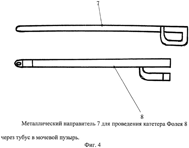 Виды катетеров для мочевого пузыря для женщин фото и описание