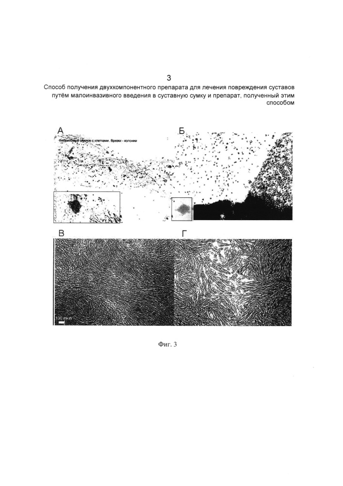 Способ получения двухкомпонентного препарата для лечения повреждения суставов путем малоинвазивного введения в суставную сумку и препарат, полученный этим способом (патент 2638796)