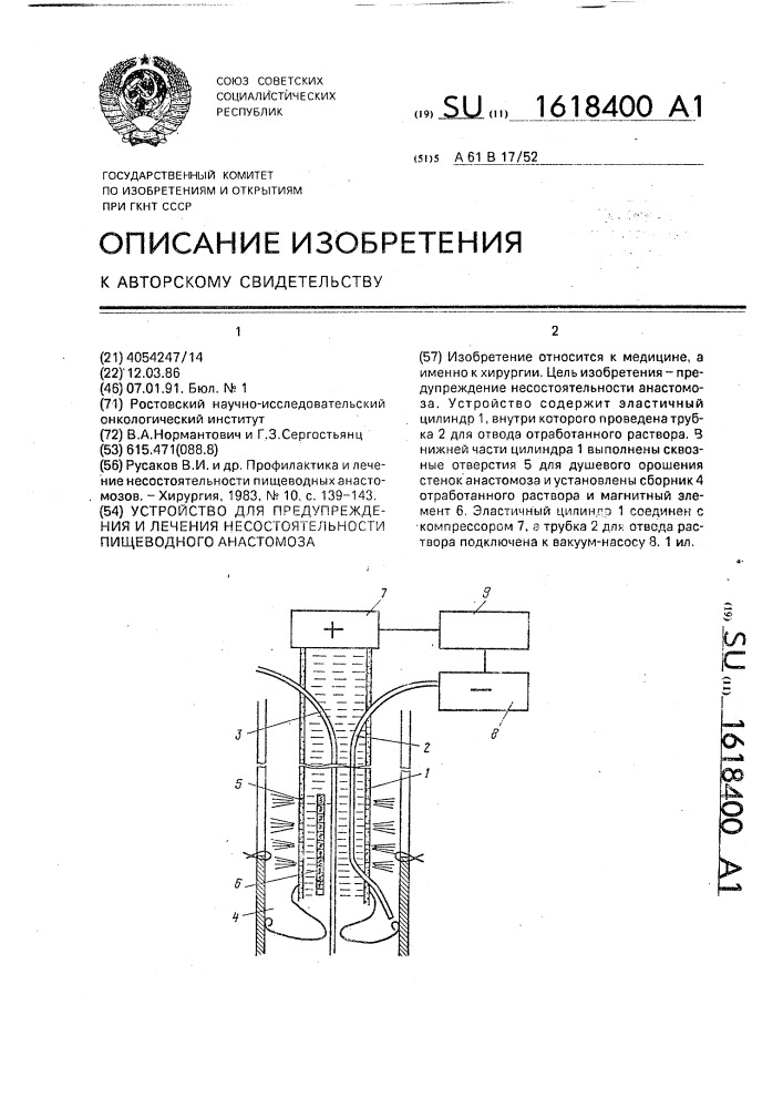 Устройство для предупреждения и лечения несостоятельности пищеводного анастомоза (патент 1618400)