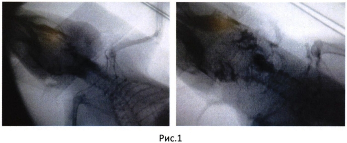 Способ диагностики лимфо- и ангиоархитектоники щитовидной железы (патент 2570535)