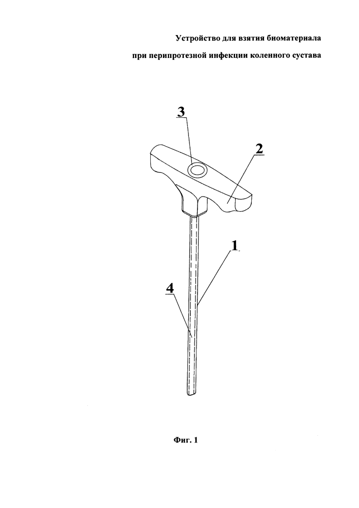 Устройство для взятия биоматериала при перипротезной инфекции коленного сустава (патент 2638786)