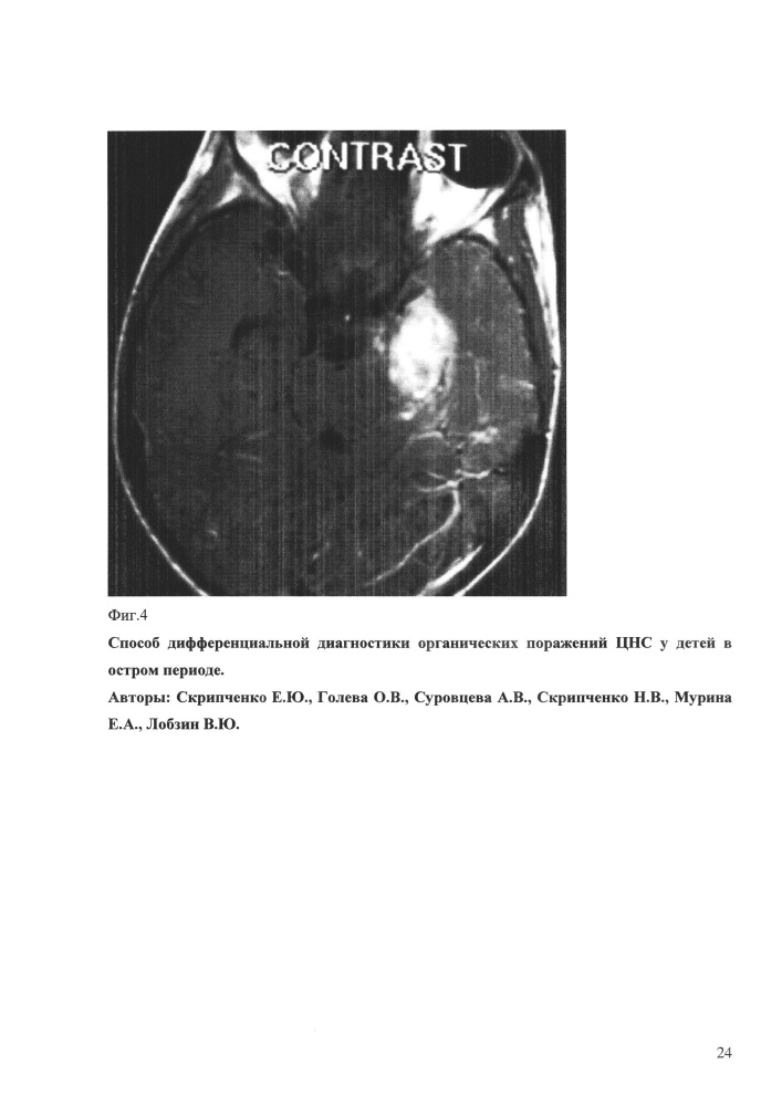 Способ дифференциальной диагностики органических поражений цнс у детей в остром периоде (патент 2648215)