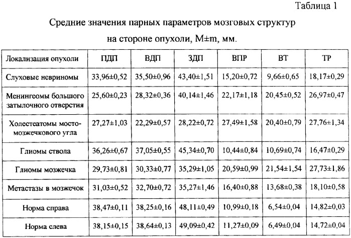 Способ диагностики опухолей задней черепной ямки (патент 2338466)