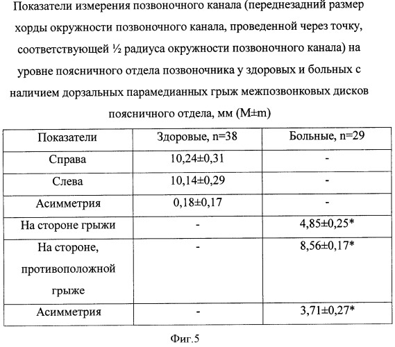 Способ ультразвуковой диагностики дорзальных парамедианных грыж поясничных межпозвонковых дисков (патент 2371096)