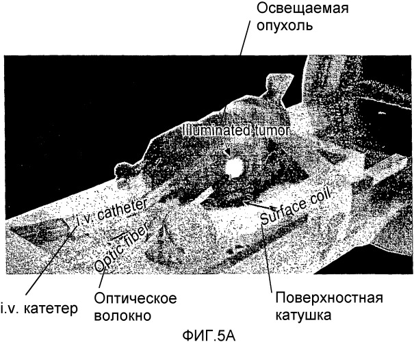 Сенсибилизированный оперативный bold-mri способ получения изображения (патент 2343829)