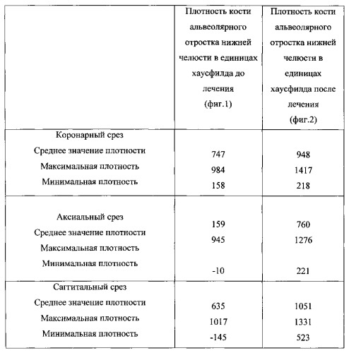 Способ восстановления тканей пародонта (патент 2558988)