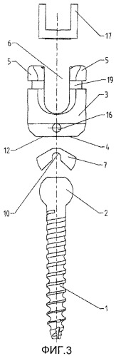 Спинальный шуруп (патент 2549017)