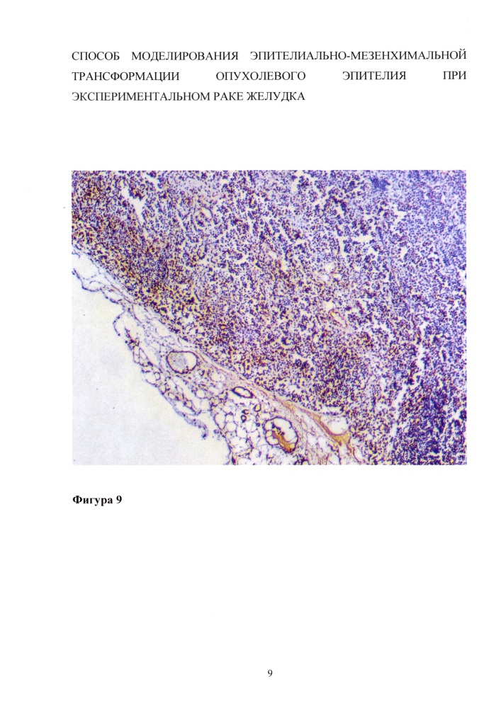 Способ моделирования эпителиально-мезенхимальной трансформации опухолевого эпителия при экспериментальном раке желудка (патент 2626717)