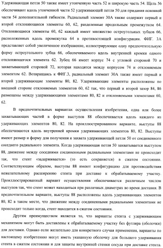 Баллонный расширяющийся стент, способный на восстановление расширения (патент 2388433)